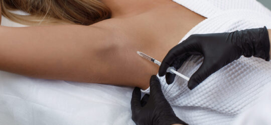 The doctor makes intramuscular injections of botulinum toxin in the underarm area against hyperhidrosis.